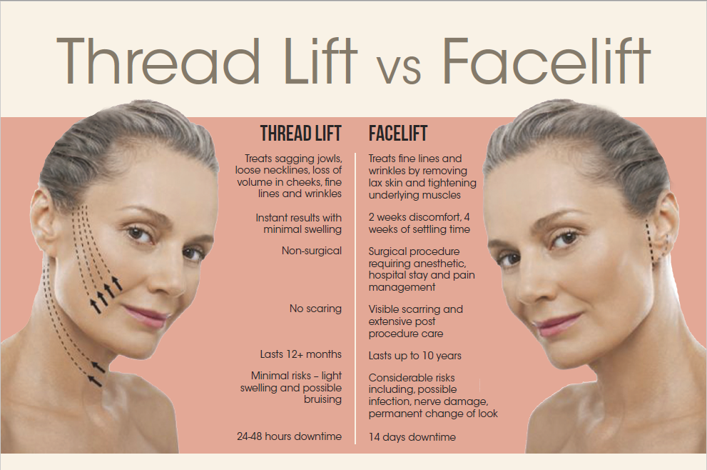 difference between a thread lift and facelift