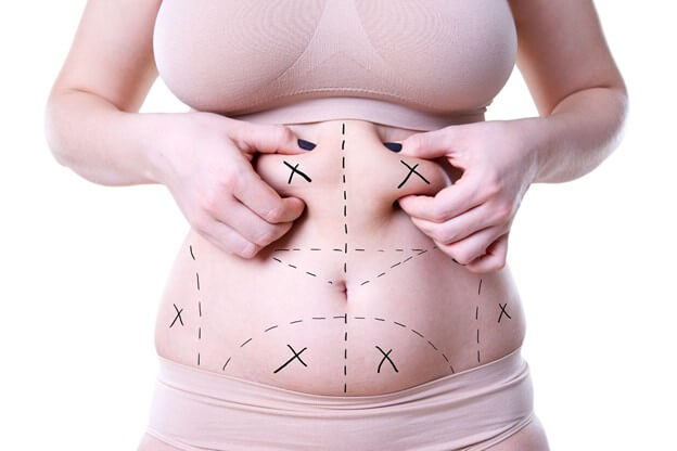 how much fat can be removed with liposuction
