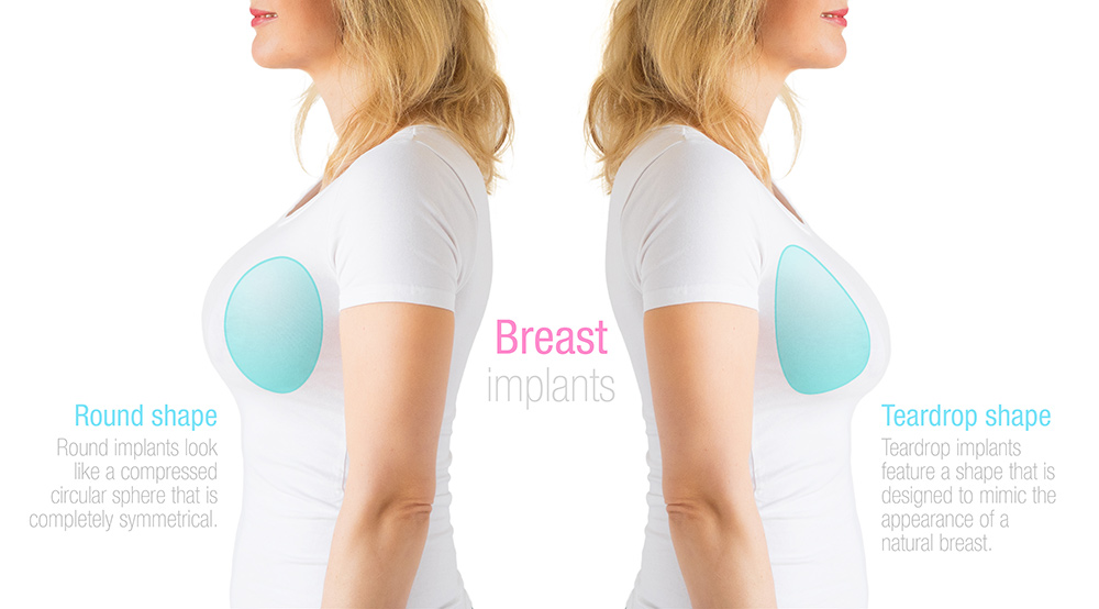 Breast Size Comparison | Breast Implant Size Selection | Breast Augmentation Sizes